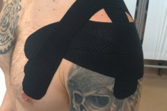 Stabilizzazione della spalla con Kinesiotape